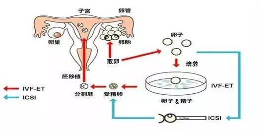 50岁借卵成功率